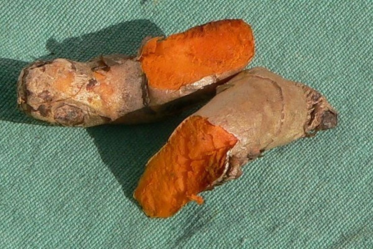 5 Cara Kunyit Bantu Redakan Nyeri Haid
